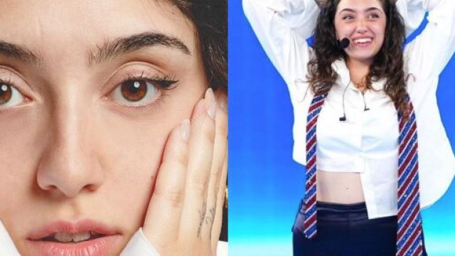 Sissi parla della sua cicatrice sul volto