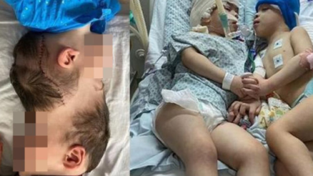 A dirigere l'intervento chirurgico sui gemelli siamesi &egrave; stato il dottor Noor ul Owase Jeelani, chirurgo pediatrico londinese.