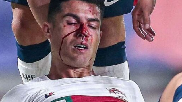 Cristiano Ronaldo en sang apr&egrave;s un choc, la vid&eacute;o buzze (capture YouTube)