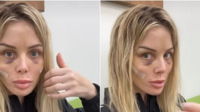 Jessica Thivenin d&eacute;voile son visage apr&egrave;s son lifting et choque Twitter. (Scrennshots @ Snapchat)