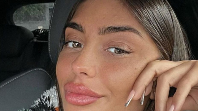 Cynthia partage son exp&eacute;rience traumatisante avec un produit cosm&eacute;tique d&eacute;fectueux. (screenshot Instagram @iam_thiaaa)