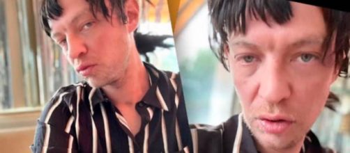 El hijo de Camilo Sesto aparec&iacute;a con marcas en los brazos (Instagram, camiloblanesoficial)