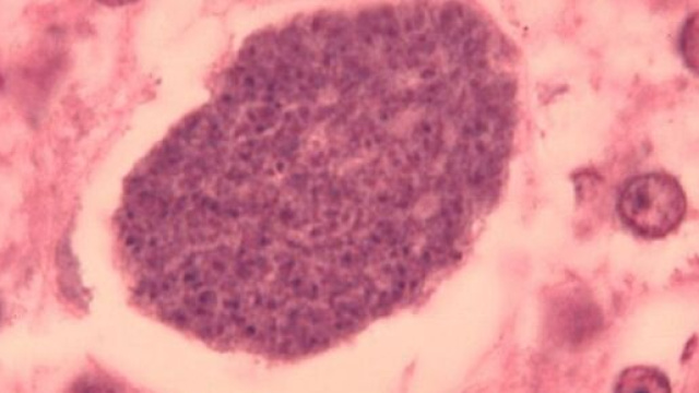 Il parassita responsabile della malaria attacca i globuli rossi &copy; Wikimedia Commons