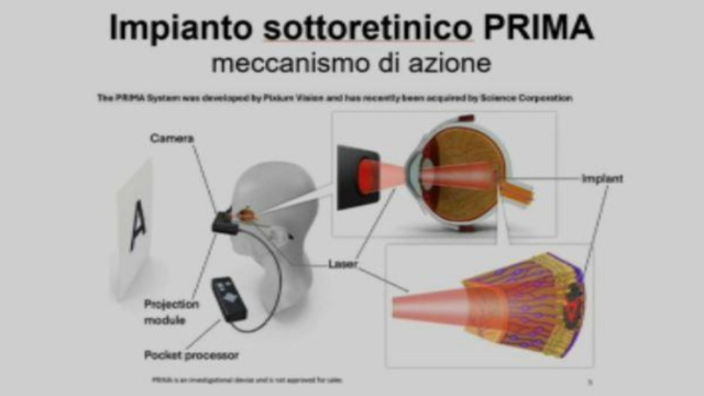 Maculopatia, un microchip per ritornare a vedere &copy; Creative Commons