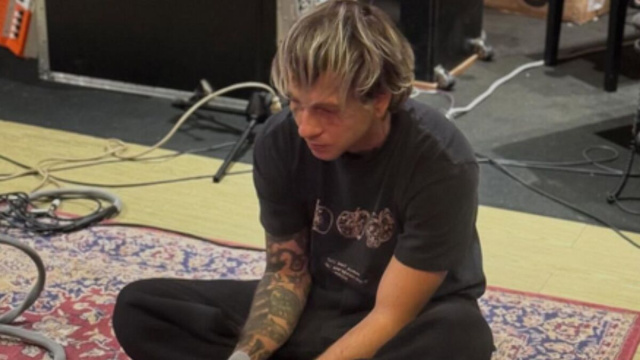 Chiello, nome d'arte di Rocco Modello (Instagram Chiello).