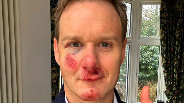 Dan Walker warns cyclists after bike crash - 'The helmet I was ... &copy; Creative Commons