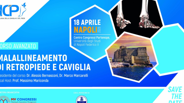 MALALLINEAMENTO DI RETROPIEDE E CAVIGLIA &ndash; SICP &copy; Creative Commons