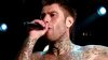 Nuovo sanguinamento per Fedez: il rapper trasferito d'urgenza all'Humanitas