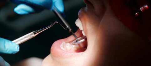 La Giunta VdA rinnova l'odontoiatria sociale per chi è in difficoltà