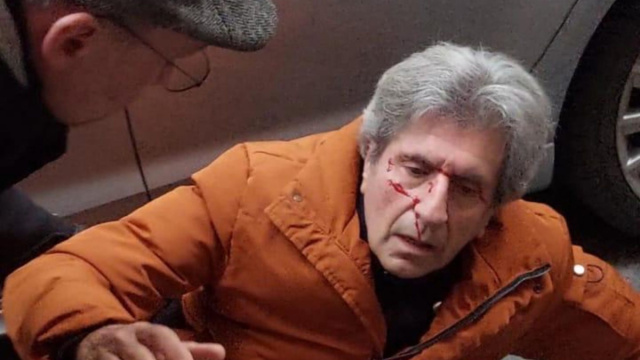 Gianni Ippoliti dopo l'aggressione: "Serve una legge contro i ... &copy; Creative Commons