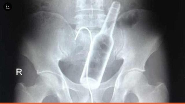 Veja objetos já flagrados por um raio-X