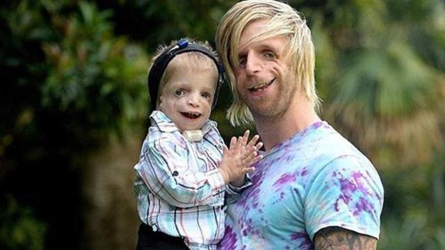 Assista: Jono Lancaster superou o abandono de seus pais e vive uma vida feliz