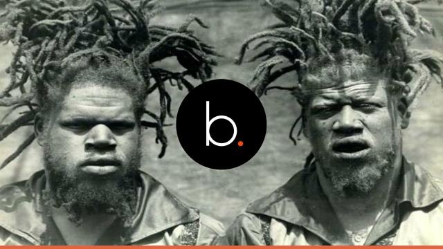 Eko and Iko (a.k.a.George and Willie Muse) were considered freaks 