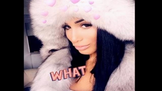 Leana (LPDLA5) avant et après la chirurgie esthétique !