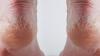 ¿Cansado de las grietas en los pies? Conoce AQUÍ la solución 