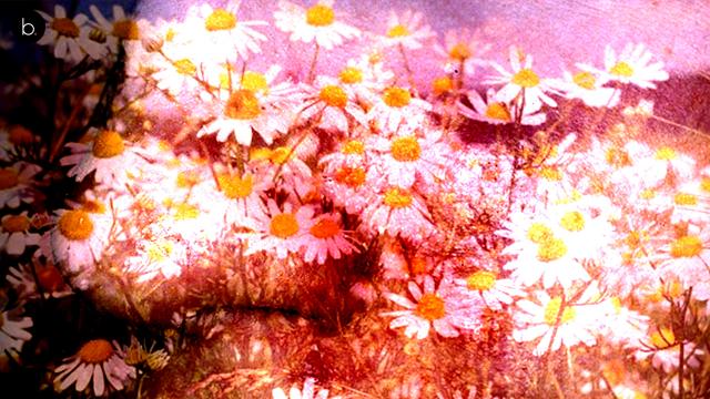 Remedios caseros para la dermatitis seborreica