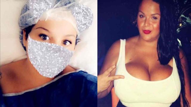 Sarah Fraisou (LVDA3) a subi une réduction mammaire