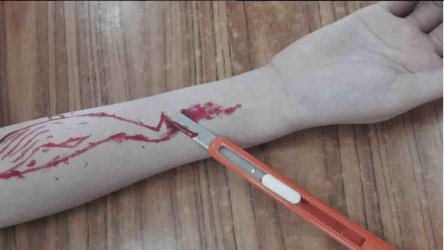 Blue Whale, tredicenne salvata in extremis: stava per togliersi la vita
