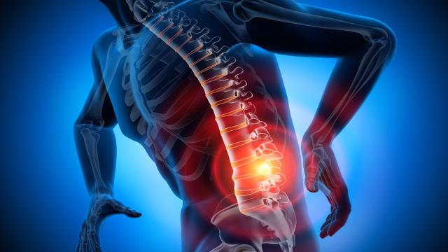 Ernia del disco: sintomi, esercizi, cure ed intervento