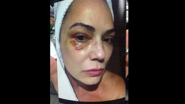 Famosas que já sofreram nas mãos de homens violentos