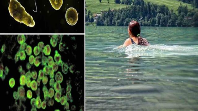 Usa, bimba muore per meningite provocata da un'ameba 'mangia cervello'