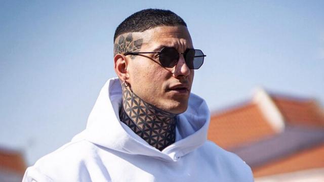 Francesco Chiofalo è andato all'ospedale perché le sue labbra hanno iniziato a gonfiarsi