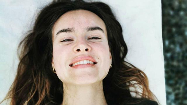 Kasia Smutniak mostra la vitiligine che l'ha colpita da sette anni