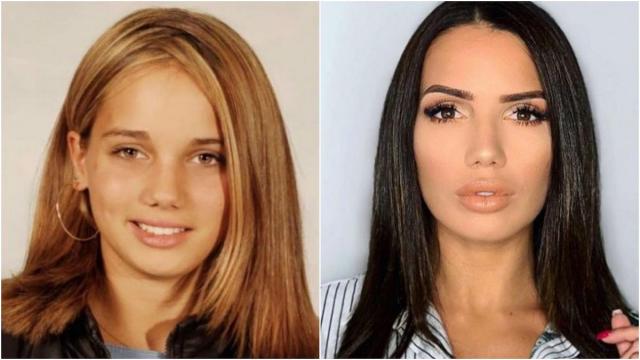 Manon (LMAC) publie une photo d'elle adolescente et s'explique sur ses chirurgies